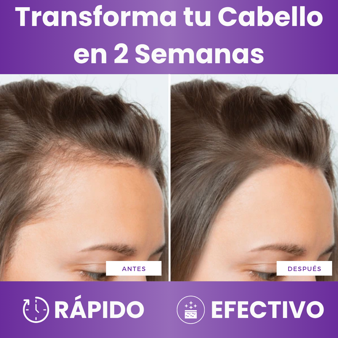 Vitaminas Lumira™ | Fórmula Avanzada para el Crecimiento Capilar 24 en 1